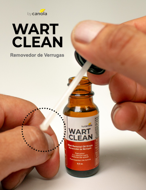 Wart Clean Wart Removal Oil Drops bottle front view